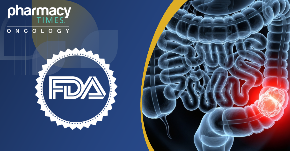 FDA Grants Priority Review to Dostarlimab for dMMR/MSI-H Locally Advanced Rectal Cancer | Pharmacy Times