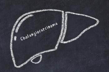 Chalk drawing of human liver with medical term. Concept of learning medicine. 