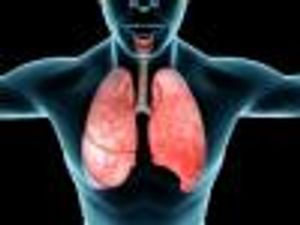 Atezolizumab Combo Improves Survival in Non–Small Cell Lung Cancer