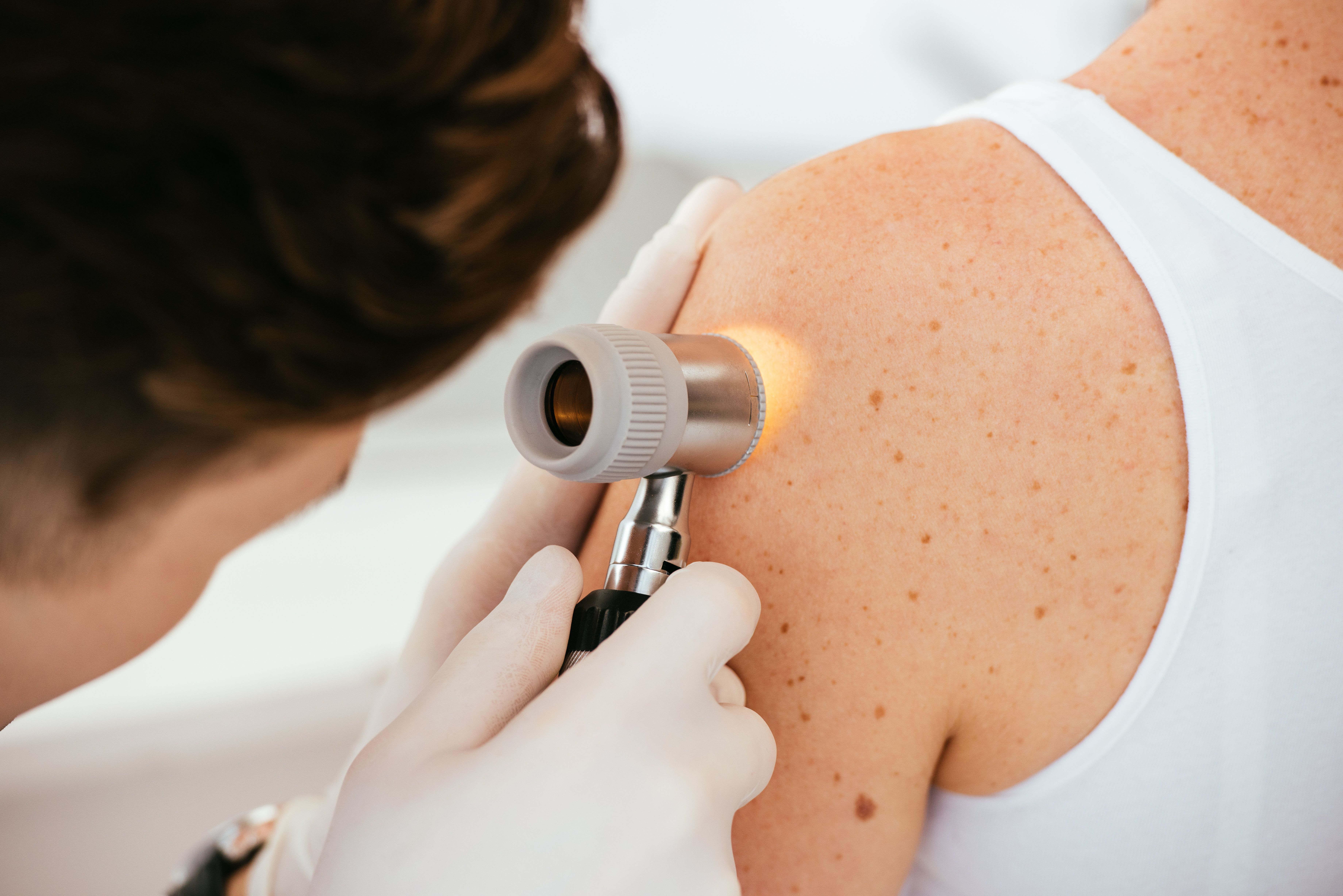 cropped view of dermatologist in latex gloves holding dermatoscope while examining patient with skin disease - Image credit: LIGHTFIELD STUDIOS | stock.adobe.com