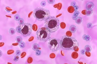 Navigating Treatment Options, Optimizing Care for Patients With CLL