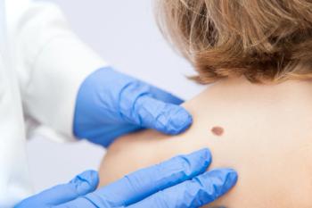 birthmark / A medical consultation at the Removal of nevus - Image credit: Damian Gretka | stock.adobe.com