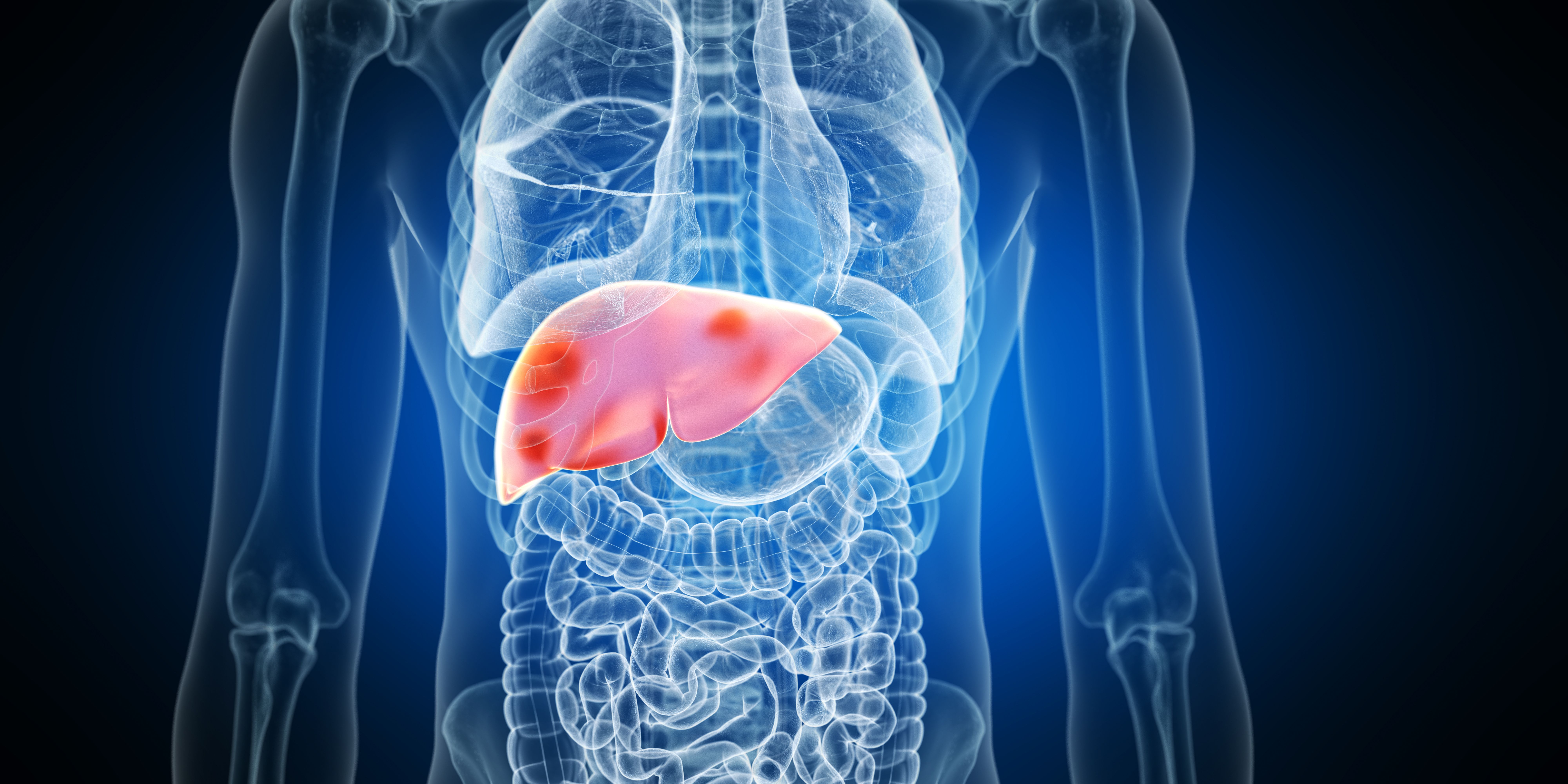 X-ray image of liver -- Image credit: Sebastian Kaulitzki | stock.adobe.com