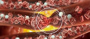 Leukemia: Causes, Symptoms, and Treatments
