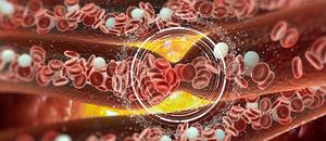 Leukemia: Causes, Symptoms, and Treatments