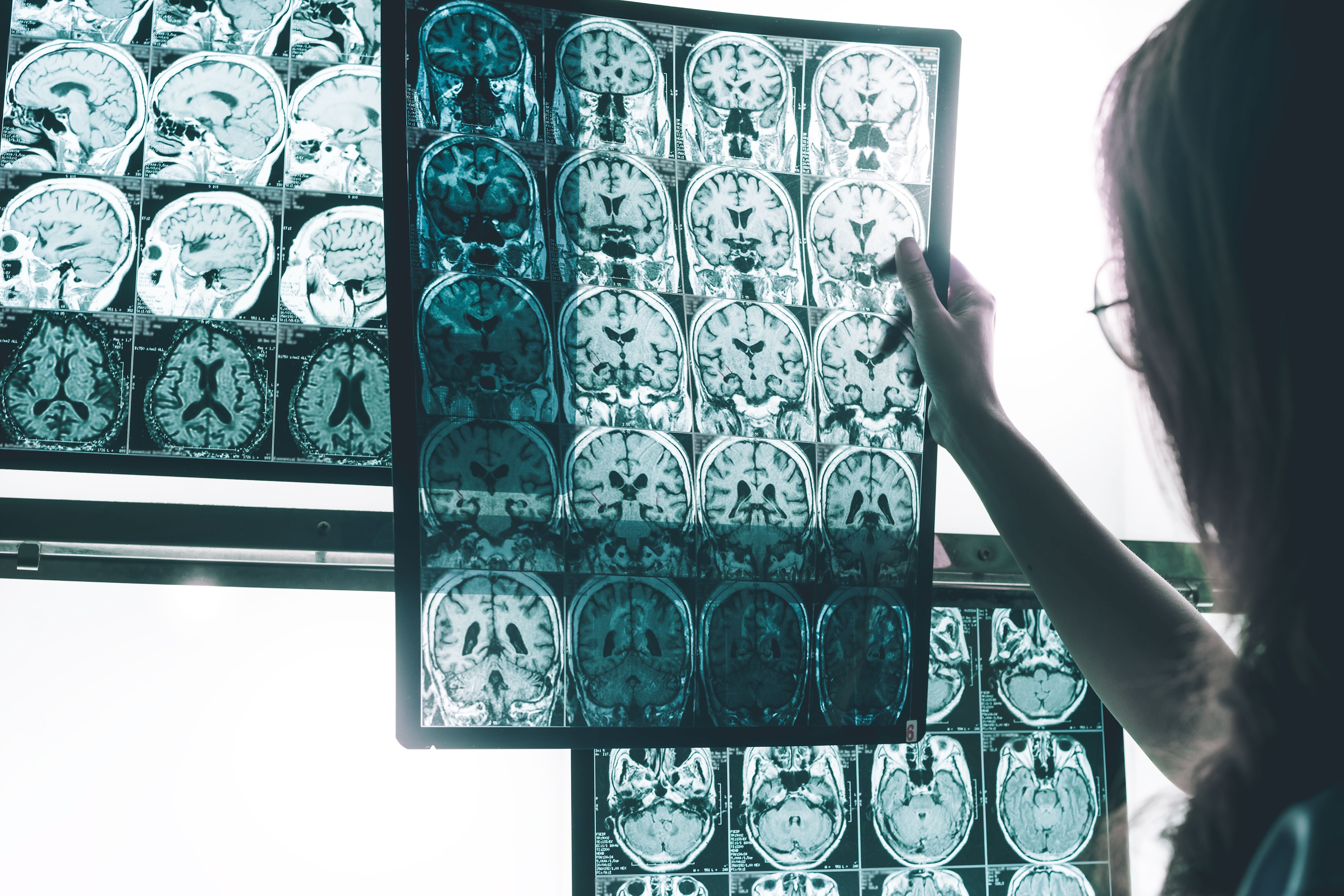 Baptist Health South Florida’s Approach to Alzheimer Disease Care