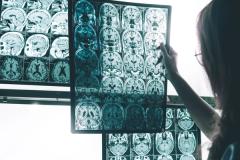 Pharmacist looking at MRI scan for Alzheimer disease -- Image credit: Atthapon | stock.adobe.com