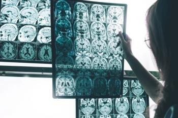 Pharmacist looking at MRI scan for Alzheimer disease -- Image credit: Atthapon | stock.adobe.com