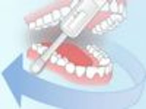 Pharmacists Ready to Help with OTC HIV Test