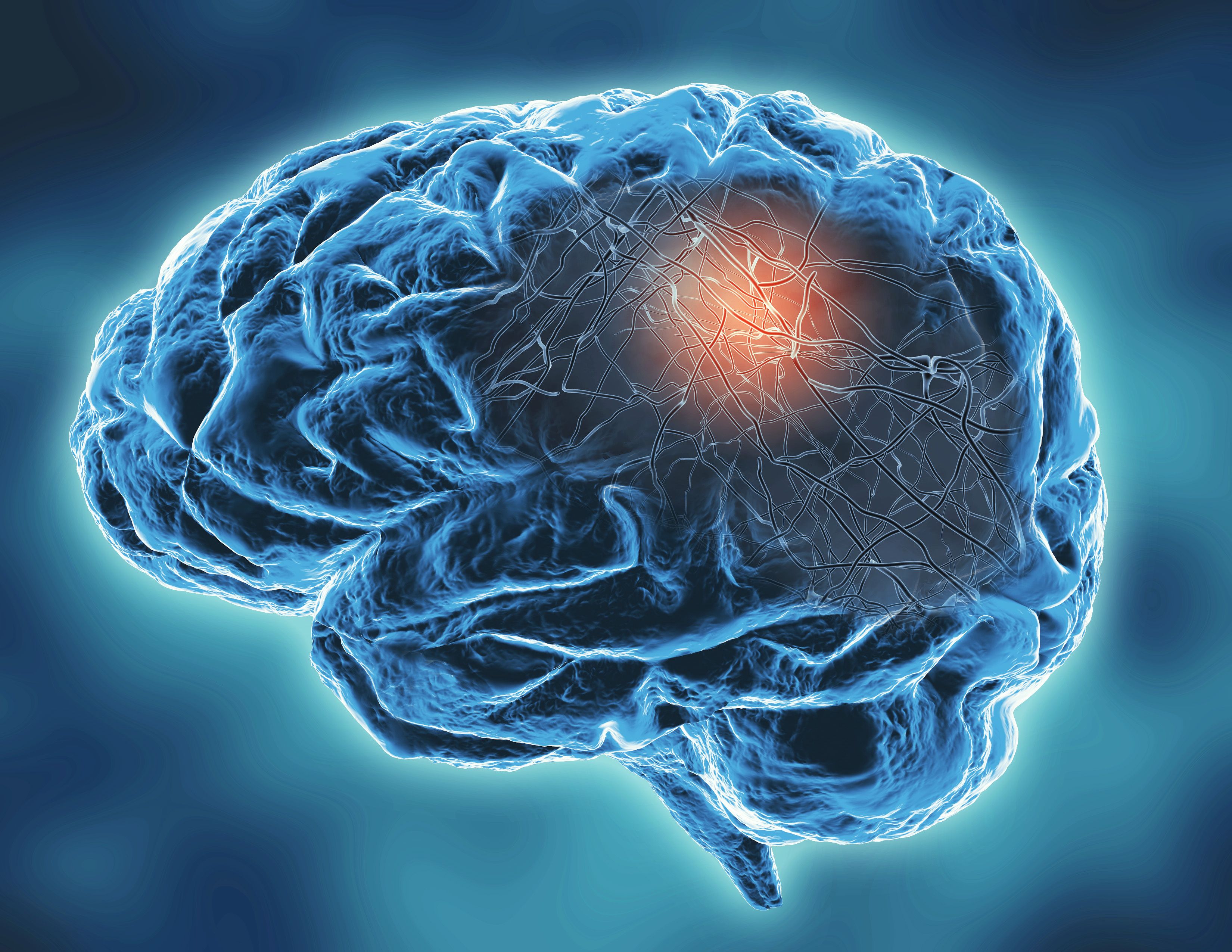 Neurodegenerative disease concept illustration with neural networks | Image credit: Picture-waterfall - stock.adobe.com