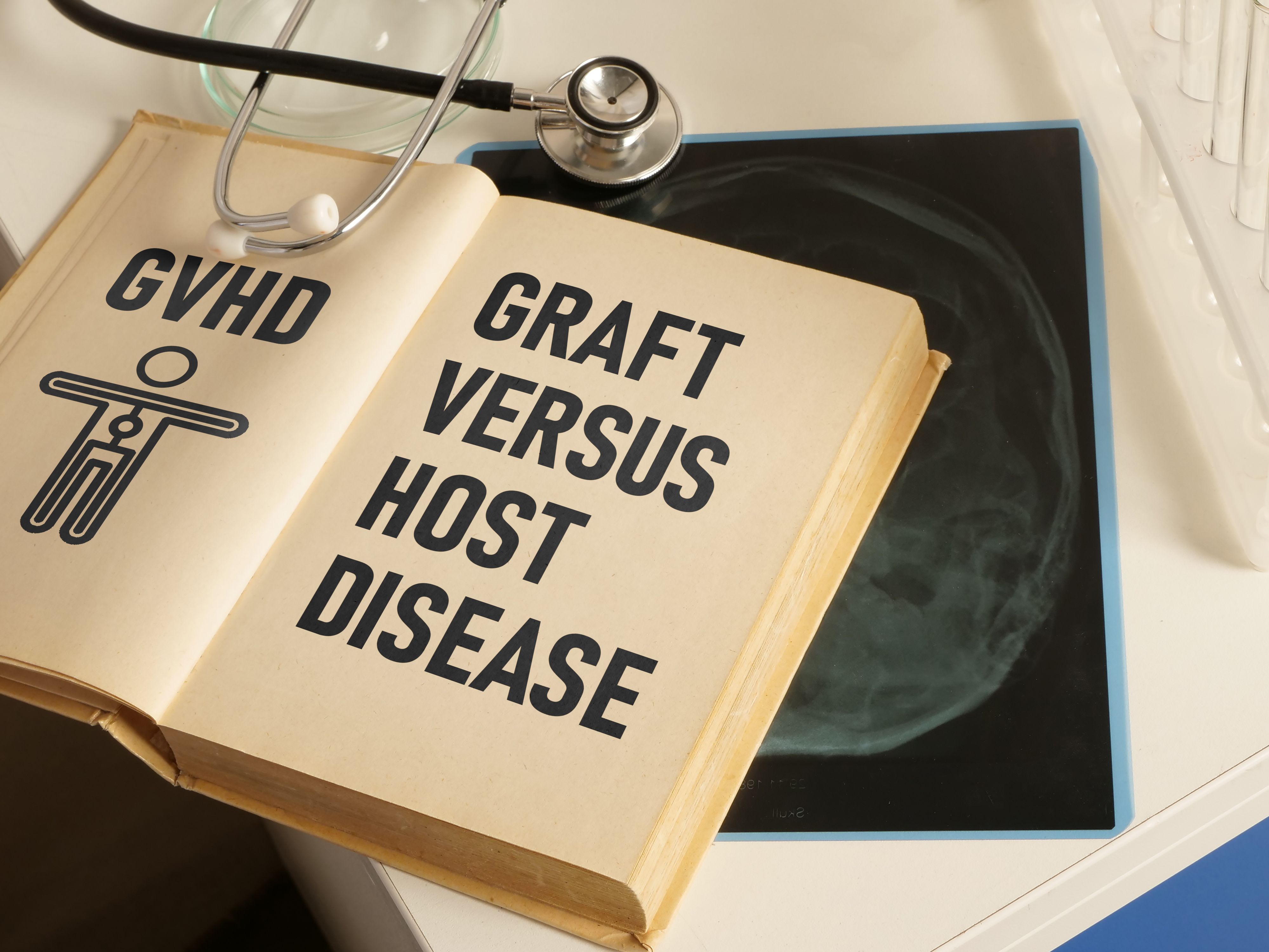 Graft versus host disease GVHD is shown using the text - Image credit: Andrii | stock.adobe.com