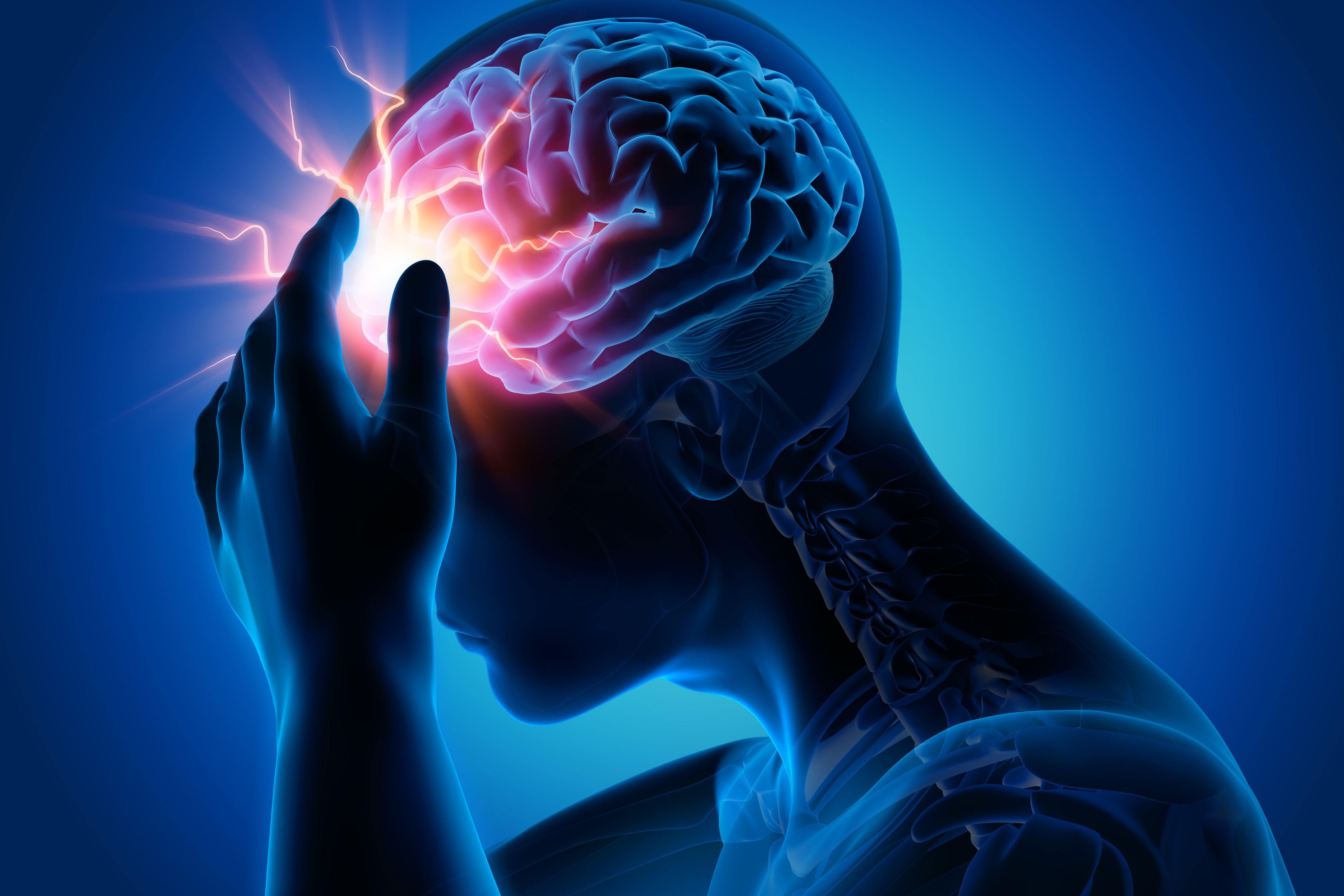 X-ray image depicting a migraine -- Image credit: peterschreiber.media | stock.adobe.com