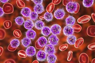 Acalabrutinib Shows Promise in CLL, Other Indications