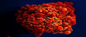 What Is the Optimal Age to Test for HIV?