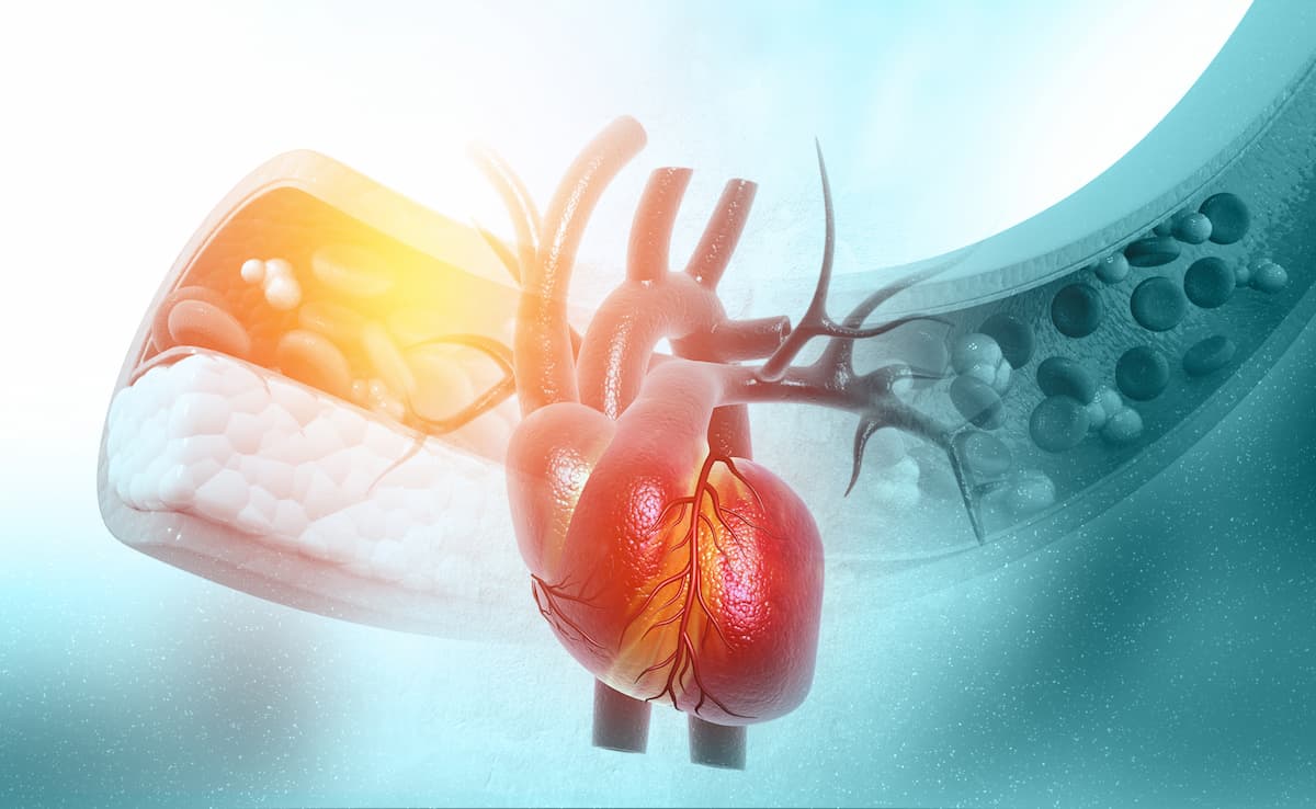 High Low-Density Lipoprotein Cholesterol Associated With Improved Survival in Acutely Decompensated Heart Failure