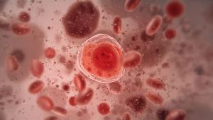 Flame-shaped plasma cells associated with multiple myeloma, focusing on disease awareness | Image Credit: The 2R Artificiality | stock.adobe.com