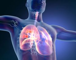 Pembrolizumab Shows Improvements in Disease-Free Survival as Adjuvant Treatment for Non-Small Cell Lung Cancer