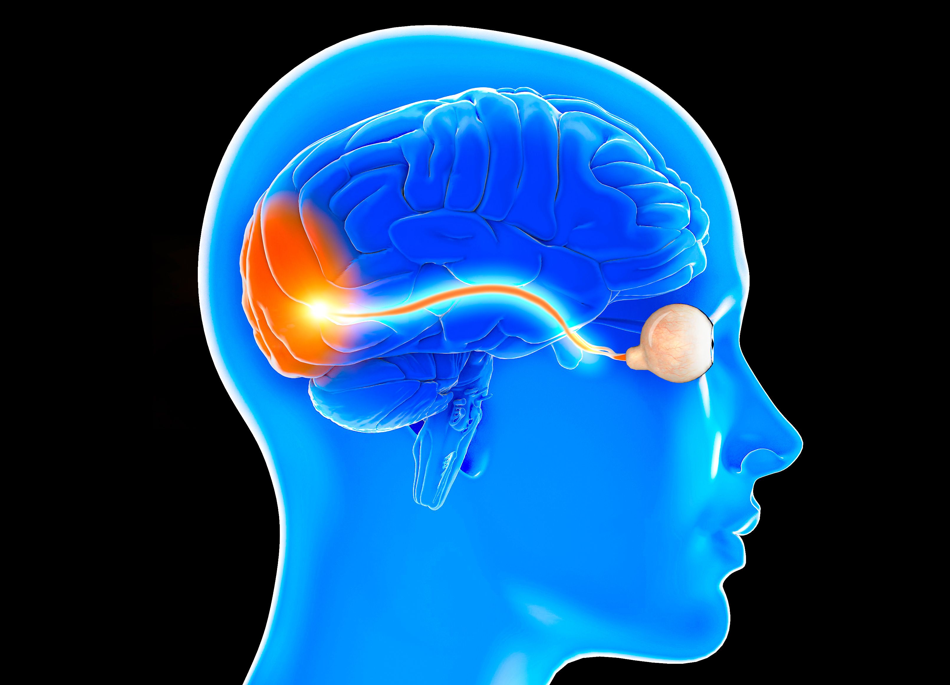 Case Study: Intravenous Immunoglobulin Can Treat Myelin Oligodendrocyte Glycoprotein Antibody-Associated Optic Neuritis in Pediatric Population