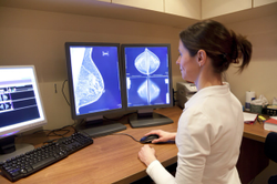 TDM1, Radiation Considered Safe for Patients with Early-Stage HER2-Positive Breast Cancer