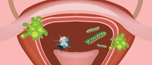 Urinary Tract Infection: A Frequent Diagnosis