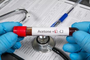 Doctor holding test tube with acetone positive result and stethoscope - Image credit: Богдан Стеблянко | stock.adobe.com