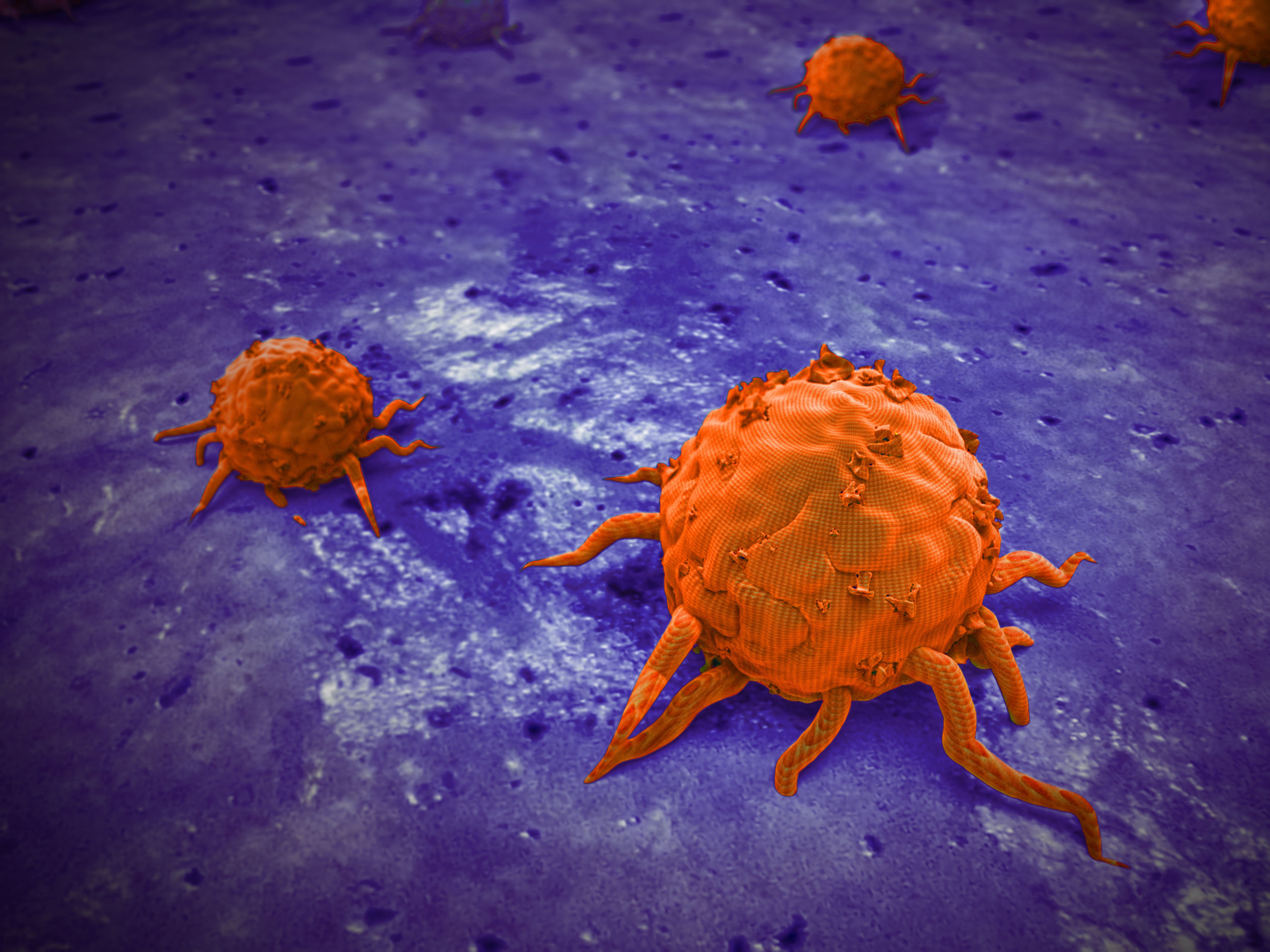 Overview of Rucaparib’s Use in Patients with Ovarian Cancer