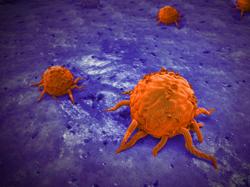 Overview of Recent Key Trials in the CTCL Space