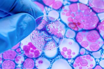 Sample of cancer cells on petri dish | Image Credit: © Ricardo MzF .com - stock.adobe.com