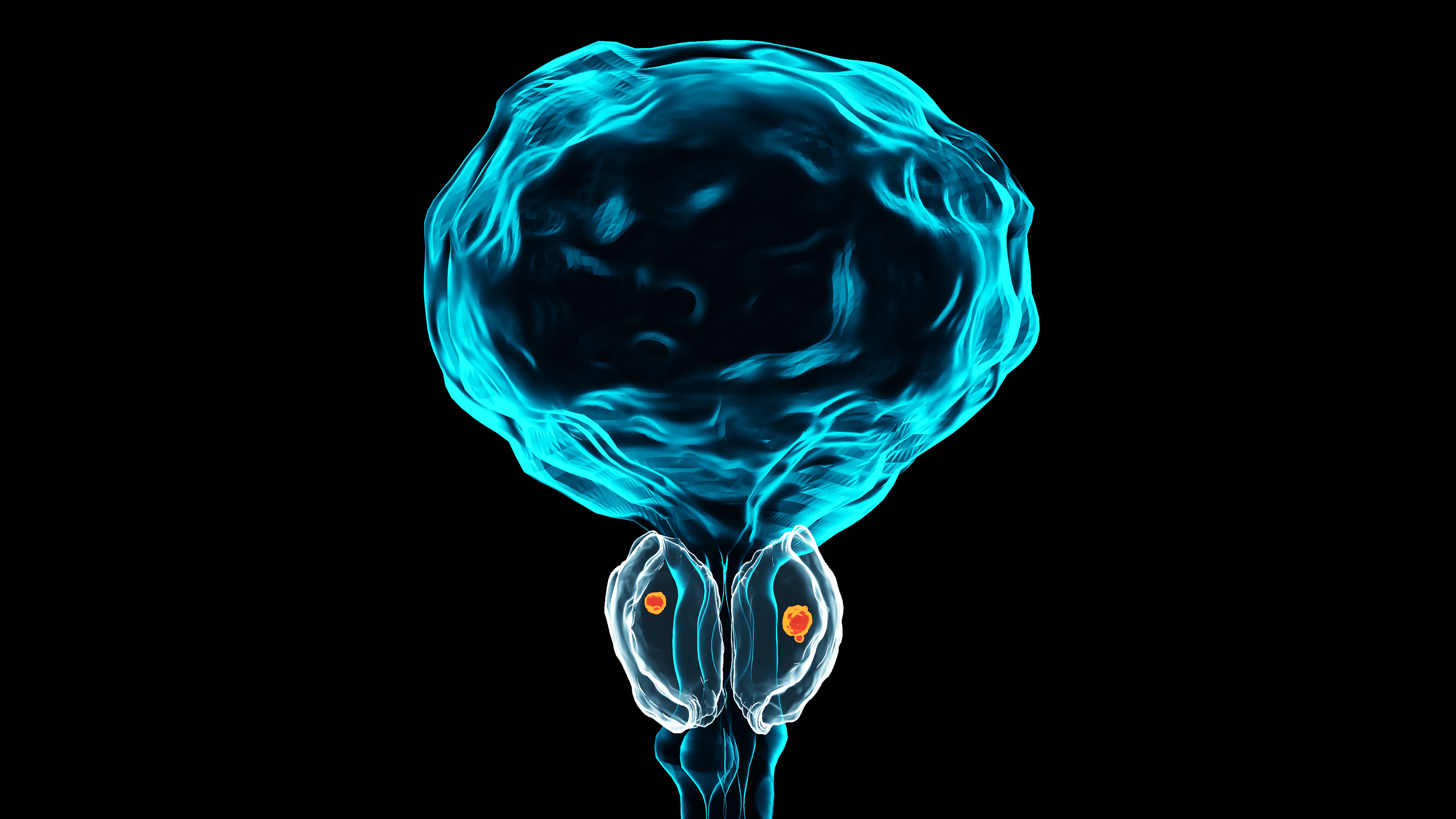 3D image of prostate cancer| Image Credit: © MohammedElAmine - stock.adobe.com