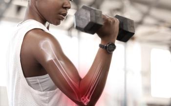 Protecting Bone Health During Breast Cancer Endocrine Therapy