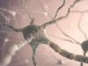 Transcranial Direct Current Stimulation Reduces Fatigue in Multiple Sclerosis