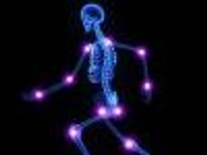 Patients with RA and No Inflammation May Experience Neuropathic Pain