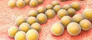 MRSA: Challenges and Updates