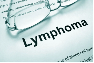 Liso-Cel CAR T-Cell Therapy May Significantly Reduce Relapse, Recurrence of Lymphoma