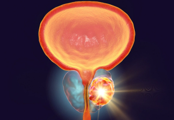 Expert discusses the complexities, monitoring needs, toxicities, and costs associated with triplet therapies in metastatic castration-sensitive prostate cancer during presentation at the HOPA Annual Conference 2023. Credit: Dr_Microbe - stock.adobe.com.
