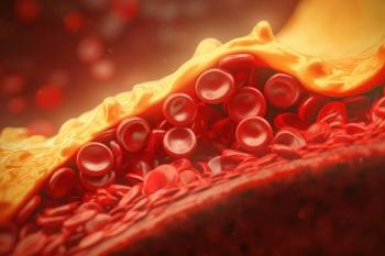 clogged arteries with cholesterol plaque, artery with blood flow obstructed by cholesterol, generative AI
