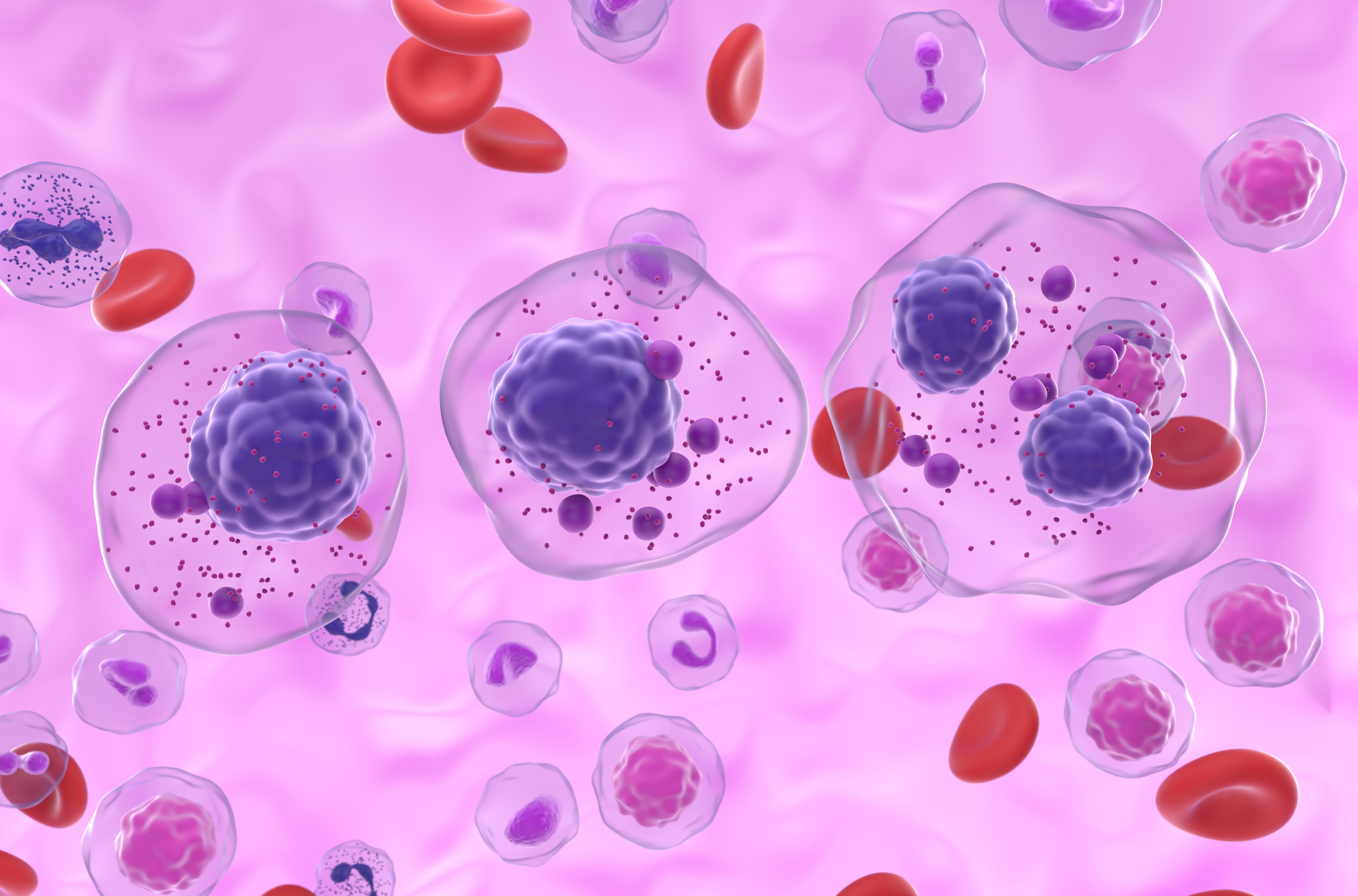 3D illustration of multiple myeloma cells | Image Credit: © LASZLO - stock.adobe.com