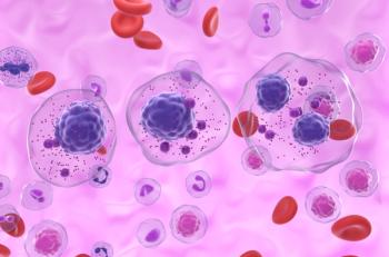 3D illustration of multiple myeloma cells | Image Credit: © LASZLO - stock.adobe.com