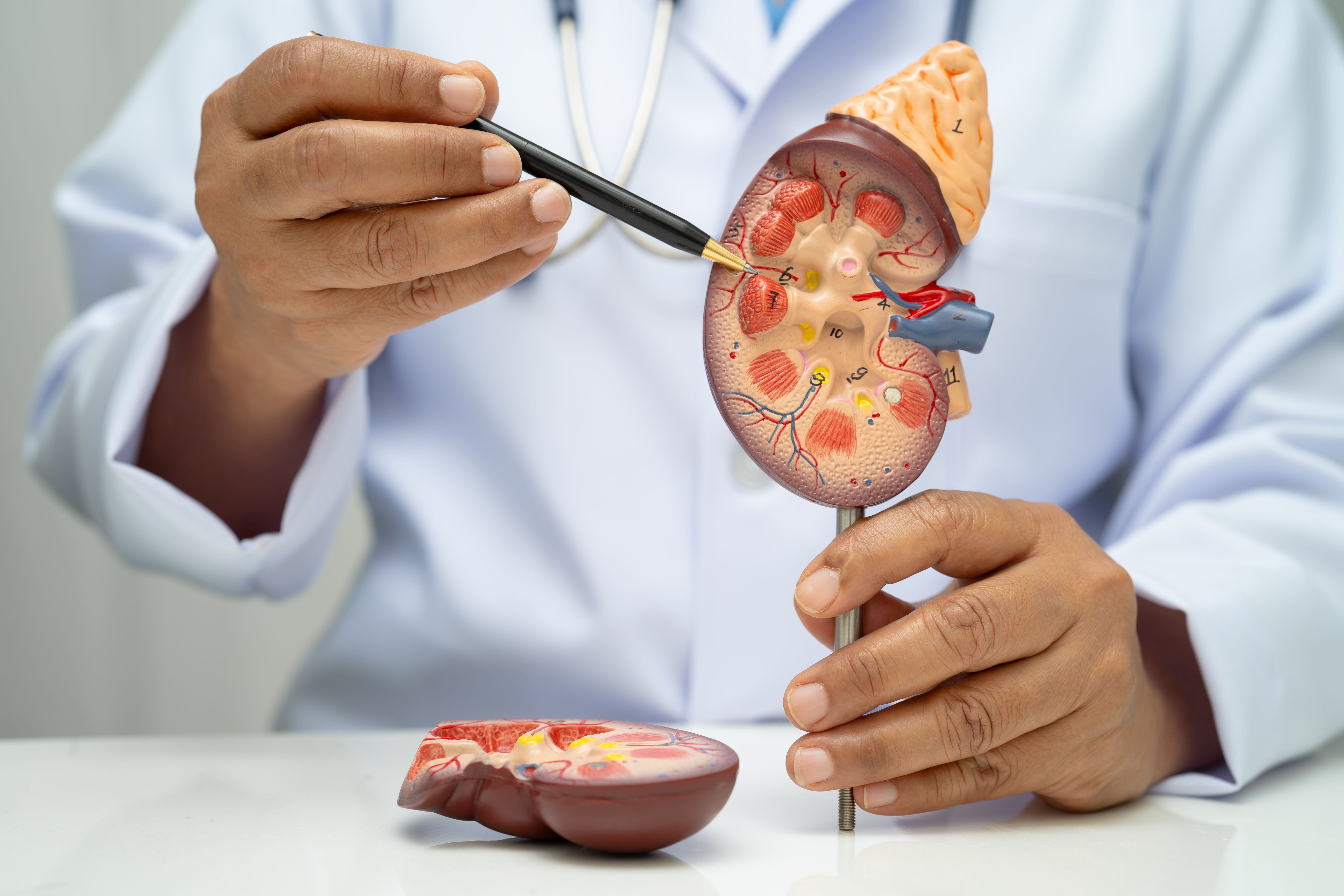 Health care professional with model depicting chronic kidney disease (CKD) -- Image credit: kanruthai | stock.adobe.com