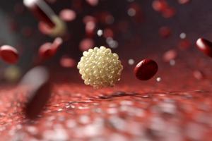 Plozasiran Slashes Triglycerides, Pancreatitis Events in sHTG