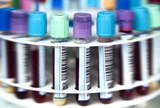 How the National Blood Shortage May Impact Patient Care, Outcomes