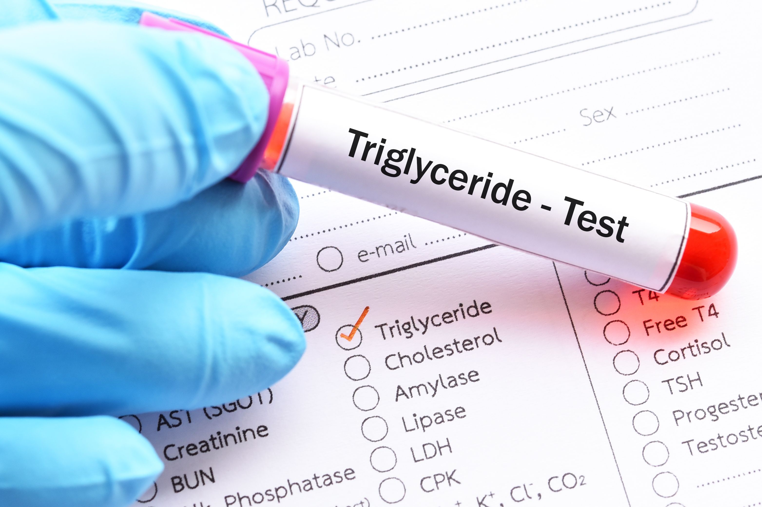Test tube with blood sample for triglyceride test | Image Credit: jarun011 | stock.adobe.com