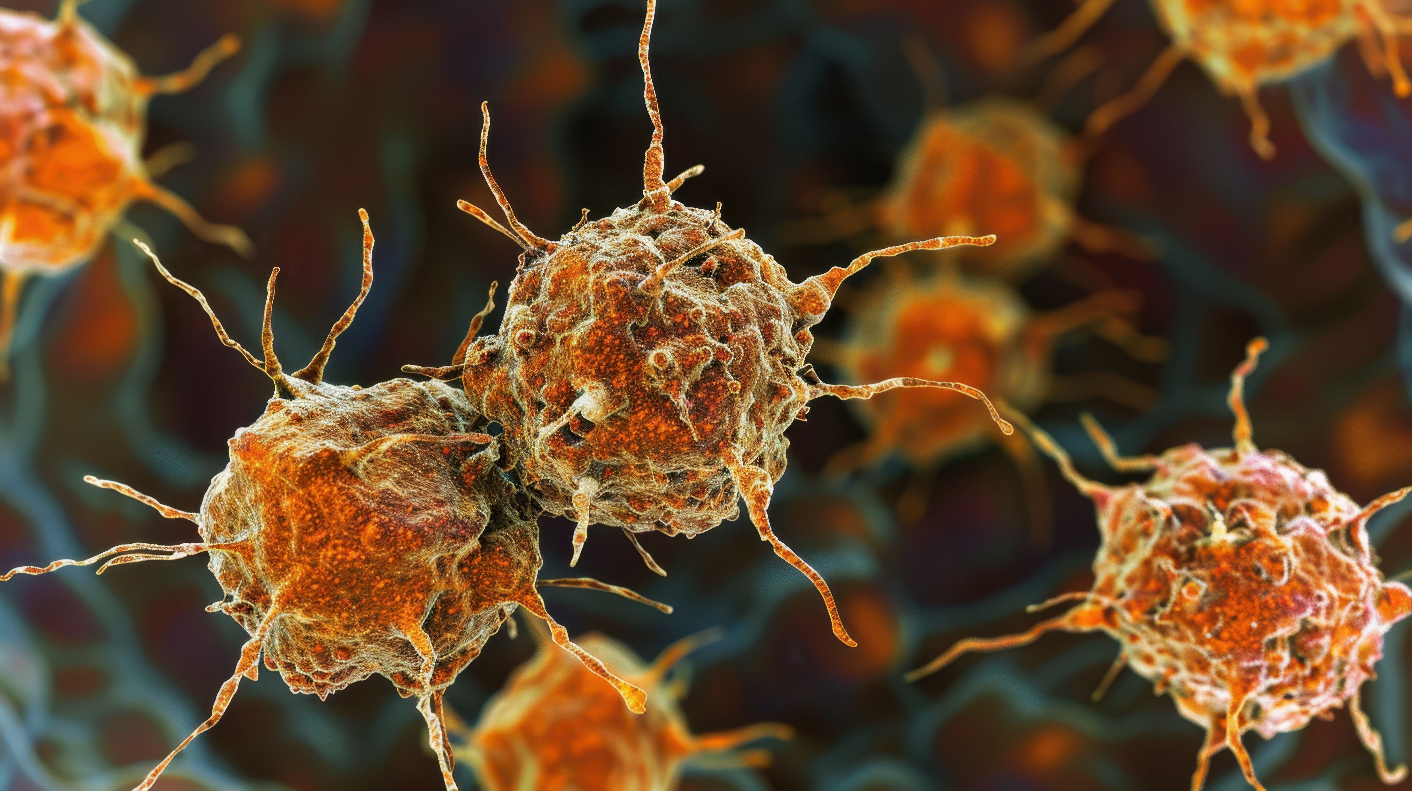 Hepatocellular Carcinoma Cells: These liver cells, or hepatocytes, can develop into tumors in the liver, often associated with cirrhosis or chronic liver disease - Image credit: Best | stock.adobe.com