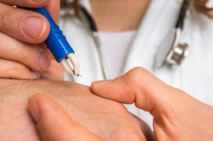 Doctor removing a tick with tweezers from hand of patient - Image credit: andriano_cz | stock.adobe.com