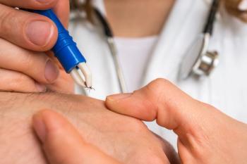 Doctor removing a tick with tweezers from hand of patient - Image credit: andriano_cz | stock.adobe.com