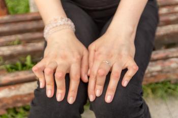 Patient with rheumatoid arthritis (RA) -- Image credit: Valentina | stock.adobe.com