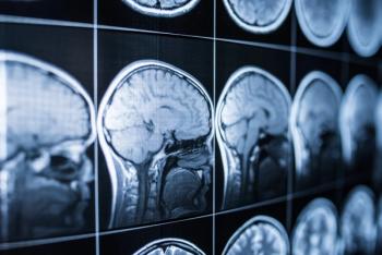 X-ray of the head and brain of a person | Image Credit: jalisko - stock.adobe.com