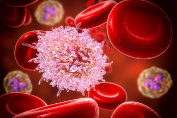 Chronic lymphocytic leukemia (CLL) -- Image credit: Dr_Microbe | stock.adobe.com