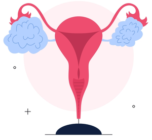 Overview of PARP Inhibitors in the Treatment of Ovarian Cancer
