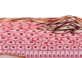 Druggable Targets for Melanoma: Skin Aquaporins